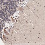 ZNF764 Antibody in Immunohistochemistry (Paraffin) (IHC (P))