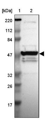 ZNF764 Antibody in Western Blot (WB)