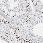 SAGE1 Antibody in Immunohistochemistry (Paraffin) (IHC (P))