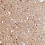 RIBC2 Antibody in Immunohistochemistry (Paraffin) (IHC (P))