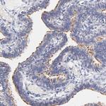 RIBC2 Polyclonal Antibody