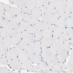 RIBC2 Antibody in Immunohistochemistry (Paraffin) (IHC (P))