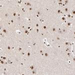 ZMYM3 Antibody in Immunohistochemistry (Paraffin) (IHC (P))