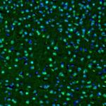 OGFOD1 Antibody in Immunohistochemistry (Paraffin) (IHC (P))