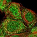 ZNF155 Polyclonal Antibody