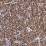 ZNF155 Antibody in Immunohistochemistry (Paraffin) (IHC (P))