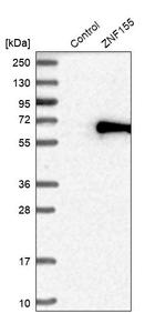 ZNF155 Antibody in Western Blot (WB)