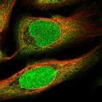 ZNF184 Antibody in Immunocytochemistry (ICC/IF)