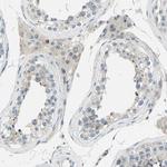 ZNF184 Antibody in Immunohistochemistry (Paraffin) (IHC (P))