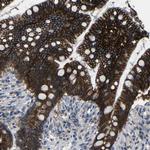 ZNF90 Antibody in Immunohistochemistry (Paraffin) (IHC (P))