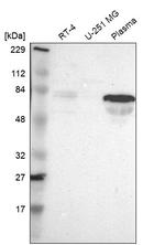 FAM117B Antibody in Western Blot (WB)