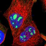 LRCH2 Polyclonal Antibody