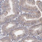 LRCH2 Antibody in Immunohistochemistry (Paraffin) (IHC (P))