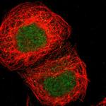 ZNF777 Polyclonal Antibody