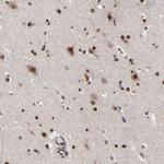 ZNF777 Antibody in Immunohistochemistry (Paraffin) (IHC (P))