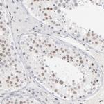 ZNF143 Antibody in Immunohistochemistry (IHC)