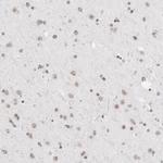 ZNF143 Antibody in Immunohistochemistry (IHC)