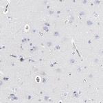 CD2AP Antibody in Immunohistochemistry (IHC)