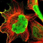 ZCCHC16 Polyclonal Antibody