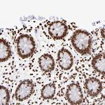 ZCCHC16 Antibody in Immunohistochemistry (Paraffin) (IHC (P))