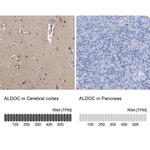 Aldolase C Antibody