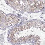 RBM44 Antibody in Immunohistochemistry (IHC)