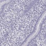 RBM44 Antibody in Immunohistochemistry (IHC)