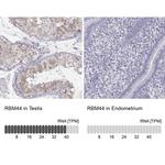 RBM44 Antibody