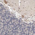 ASB8 Antibody in Immunohistochemistry (Paraffin) (IHC (P))