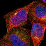 ASB7 Polyclonal Antibody