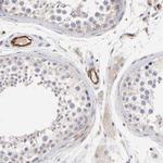 ASB7 Antibody in Immunohistochemistry (IHC)