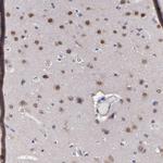 UBE2E3 Antibody in Immunohistochemistry (Paraffin) (IHC (P))