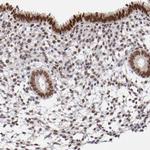 UBE2E3 Antibody in Immunohistochemistry (Paraffin) (IHC (P))