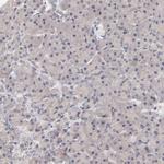 UBE2E3 Antibody in Immunohistochemistry (Paraffin) (IHC (P))