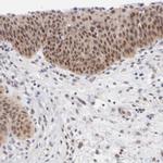UBE2E3 Antibody in Immunohistochemistry (Paraffin) (IHC (P))