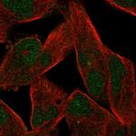 ZNF780B Antibody in Immunocytochemistry (ICC/IF)