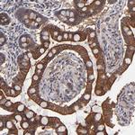 ZNF780B Antibody in Immunohistochemistry (Paraffin) (IHC (P))