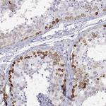 RHOXF2 Polyclonal Antibody