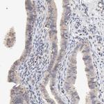 ZNF157 Polyclonal Antibody