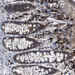 UBE2G2 Polyclonal Antibody