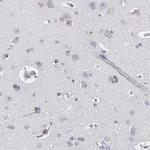 MOSPD2 Antibody in Immunohistochemistry (Paraffin) (IHC (P))