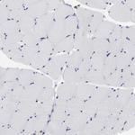 MOSPD2 Antibody in Immunohistochemistry (Paraffin) (IHC (P))