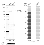 SMARCA1 Antibody in Western Blot (WB)