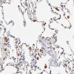 RNF213 Antibody in Immunohistochemistry (Paraffin) (IHC (P))