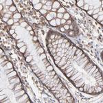 RNF213 Antibody in Immunohistochemistry (Paraffin) (IHC (P))