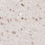 RNF213 Antibody in Immunohistochemistry (IHC)