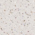 SH3KBP1 Polyclonal Antibody