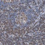 SH3KBP1 Antibody in Immunohistochemistry (Paraffin) (IHC (P))