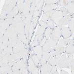 SH3KBP1 Antibody in Immunohistochemistry (Paraffin) (IHC (P))