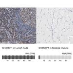 SH3KBP1 Antibody in Immunohistochemistry (IHC)
